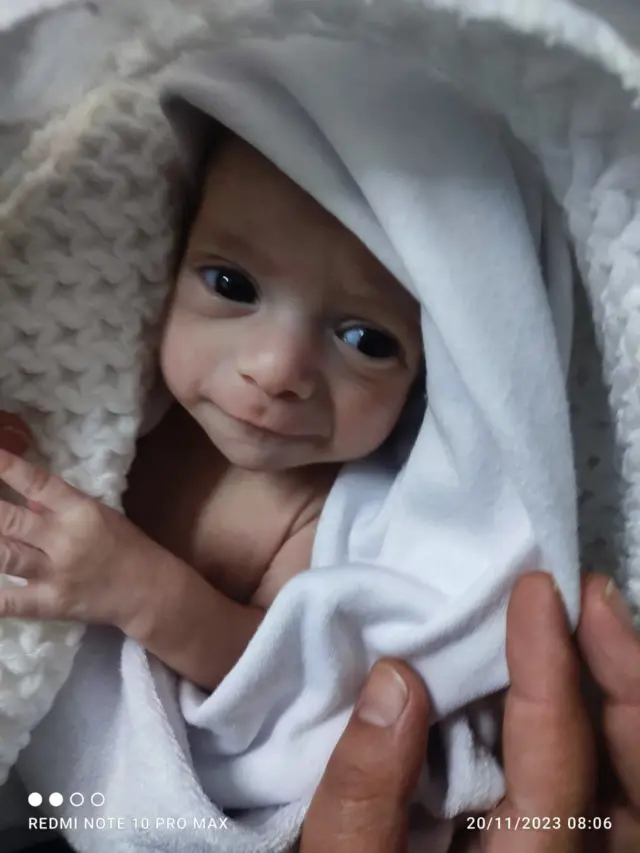 Ada banyak orang tua yang terpisah dari bayi mereka akibat konflik di Gaza. 