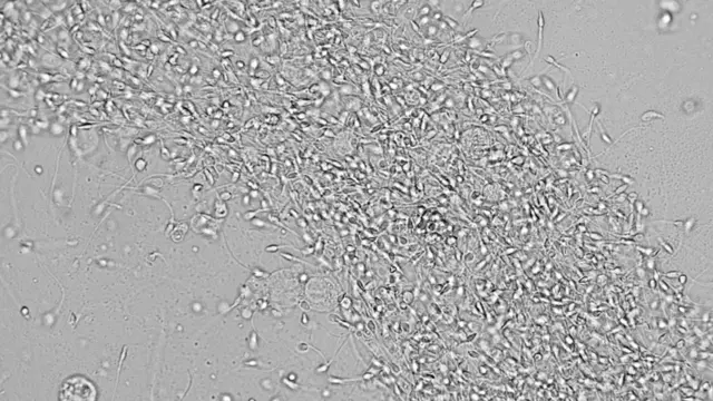 Vista microscópica de esperma en blanco y negro