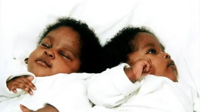 جڑواں بہنیں