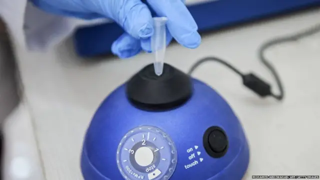 લેબની તસવીર