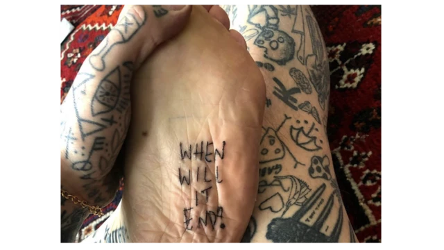 'Quando vai acabar', tatuou Chris na sola do seu pé