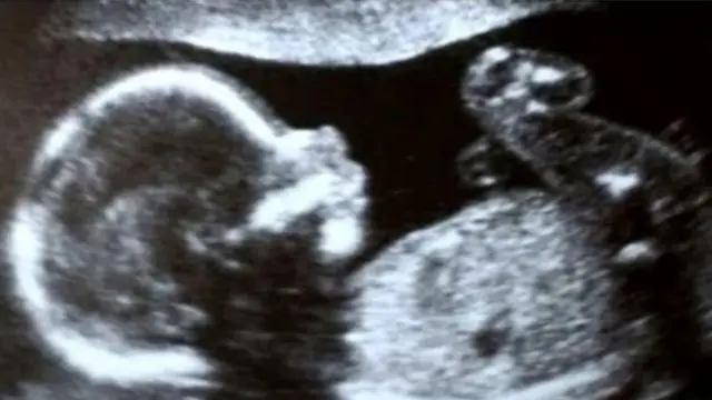 પ્રતીકાત્મક તસવીર