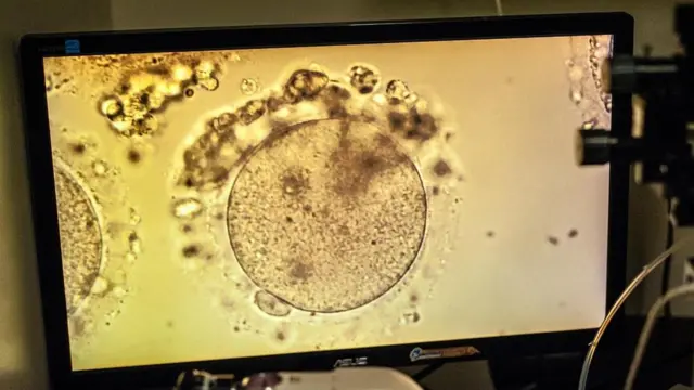 شاشة تظهر تصويرا لبويضة