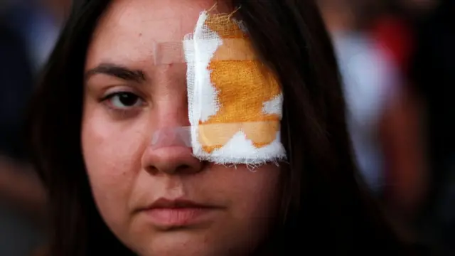 Manifestante con parche en el ojo en apoyo a Gustavo Gatica