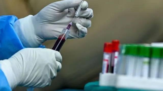 લોહીનું સૅમ્પલ