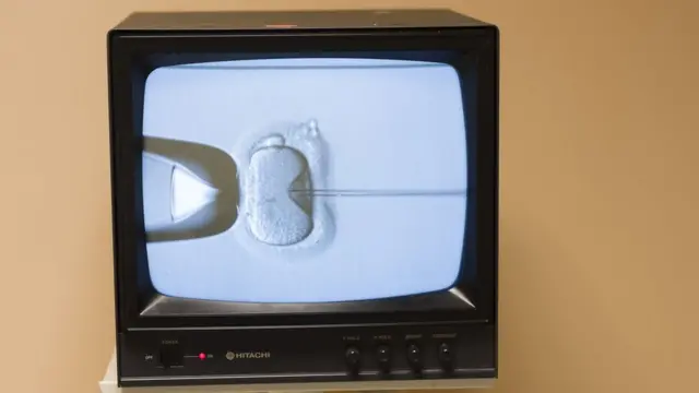 Moniteur de contrôle d'un microscope