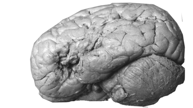 El cerebro de Monsier Leborgne