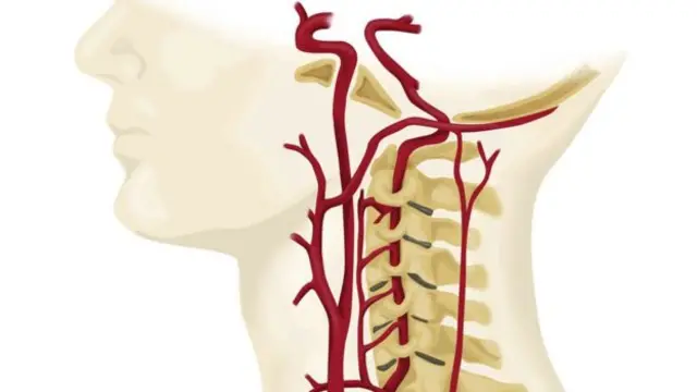 Gráfico de las arterias que pasan por el cuello.