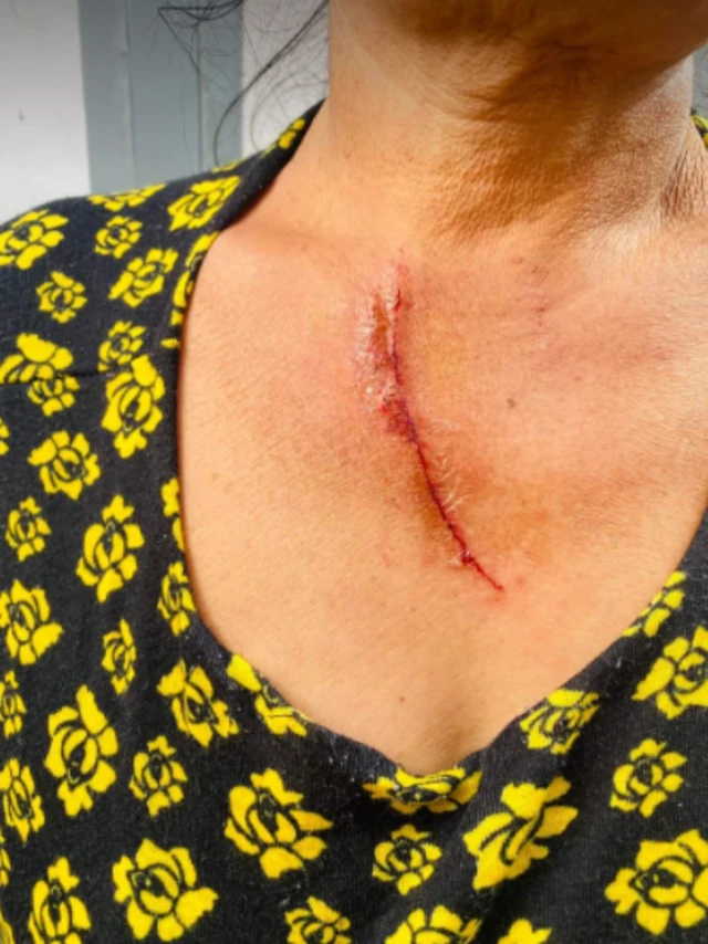 လုယက်ခံရသူ