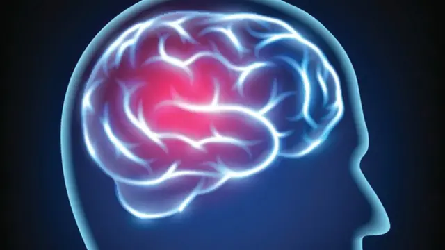 Un dibujo que representa a una persona con un dolor de cabeza.