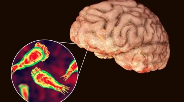 ਦਿਮਾਗ਼ ਖਾਣ ਵਾਲੇ ਅਮੀਬਾ