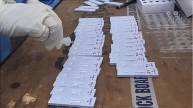 कोरोना लॅब