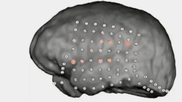 الدماغ البشري