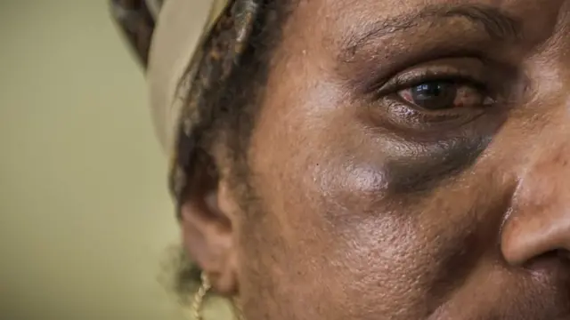 Dubartii Papua New Guinea