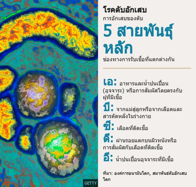 กราฟฟิค