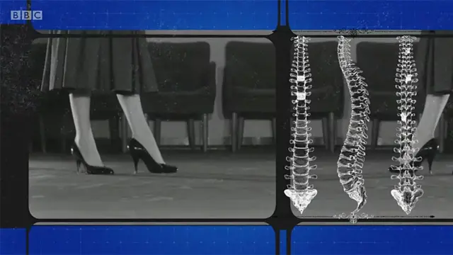 Mujer en tacones e imágenes de la columna vertebral