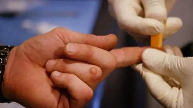 హెచ్ఐవీ పరీక్ష