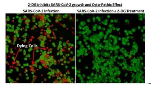 2 डीऑक्सी - डी- ग्लूकोज