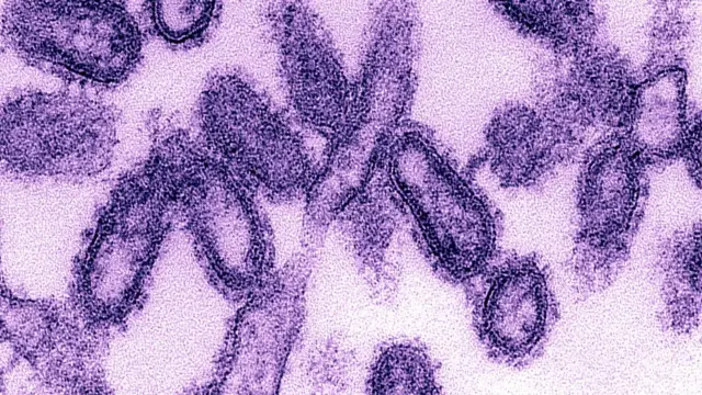 স্প্যানিশ ফ্লুর জন্যে দায়ী এইচওয়ান এনওয়ান ভাইরাস।