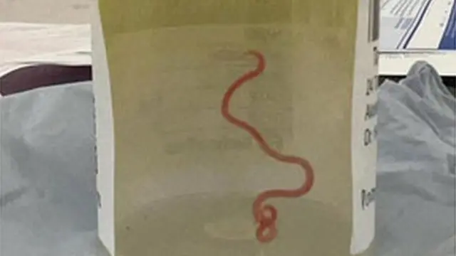 The parasite in a specimen jar