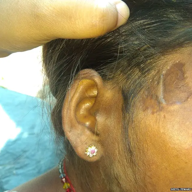 मानव तस्करी, बिहार