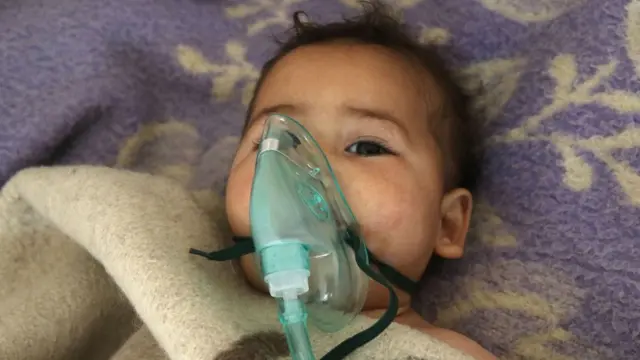A child treated after an attack in Syria on Tuesday