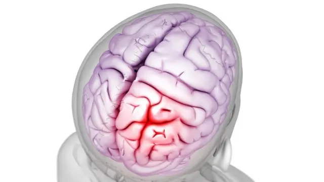 قد يصبح الصداع شديدا إلى حد يفوق قدرة المرء على التحمل