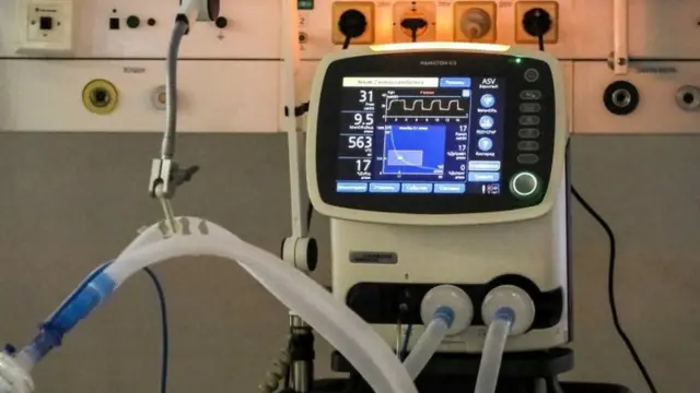 Un respirador artificial