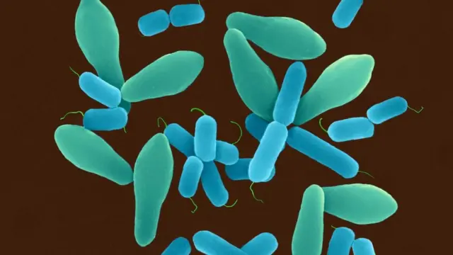 "المطثية الحاطمة"