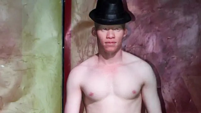 Mid ka mid ah raggii ka soo qeyb galay tartanka ugu horreeyay ee quraxda dadka uu maqaarkoodu casyahay