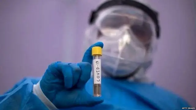 ਕੋਰੋਨਾਵਾਇਰਸ