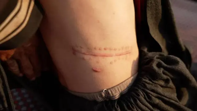 افغانستان میں بھوک کا بحران