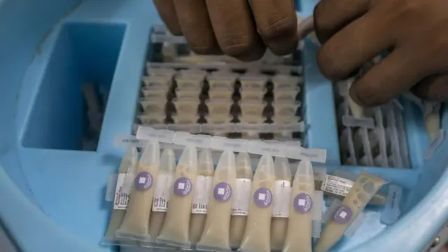 ঢাকা, বাংলাদেশ - ২০২২/০৬/২৮: টিকাদান কর্মসূচির সময় মুখে খাওয়ার কলেরা টিকা দেখা যাচ্ছে