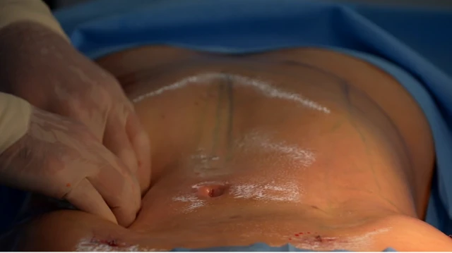 Gros plan d'un ventre d'une patiente