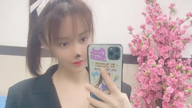 Plastic surgery: Chinese actress Gao Liu necrosis