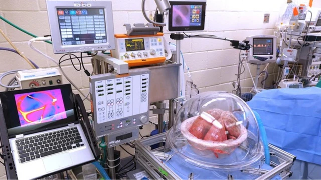 การทดลองเชื่อมต่อปอดมนุษย์ (ในครอบแก้วใส) เข้ากับกระแสเลือดของหมูเป็น ๆ ที่ถูกวางยาสลบอยู่ (ใต้ผ้าคลุมสีฟ้า)