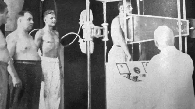 Manoel Dias de Abreu avec des patients de la tuberculose.