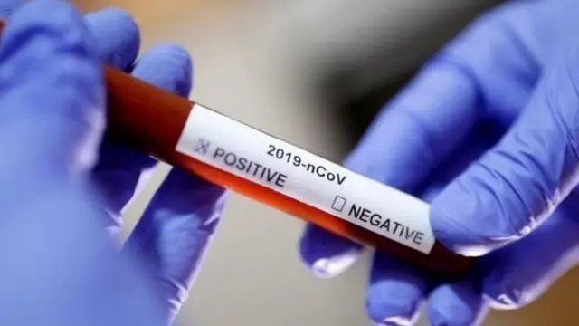 कोरोना टेस्ट