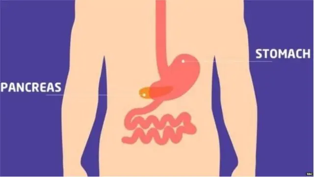 मधुमेही