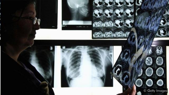 「蜂群智能」模式可幫助醫生使用X光診斷肺炎時減少三分之一的誤診。