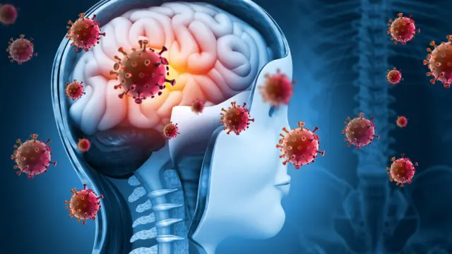 Brain viral infection, Viral meningitis and encephalitis 3d illustration
