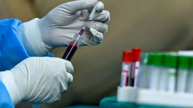 ప్లాస్మా థెరపీ