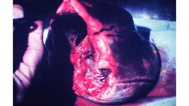 Transplante cardíacoapostar na mega sena pelo aplicativo da caixaJoão Ferreira da Cunha