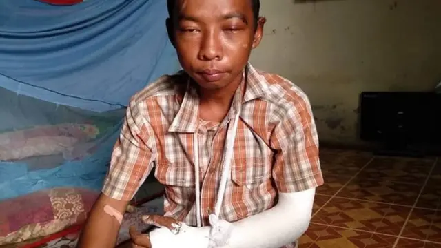 တစ်ကိုယ်လုံးမှာလည်း အနာတွေပေါက်နေပြီး ခွဲစိတ်ကုသမှုတွေ ဆက်လုပ်ဖို့ အချိန်စောင့်ဖို့လို