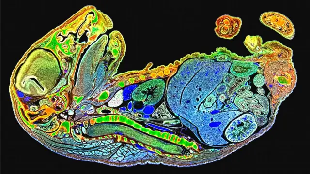 Spike Walker/ Cortesía de la Royal Photographic Society