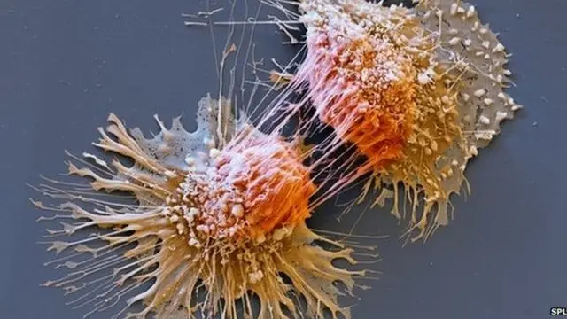 Célula cancerígena dividiéndose