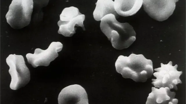 Kwayoyin jinin mai amosanin jini