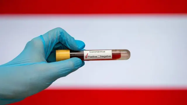 করোনাভাইরাস