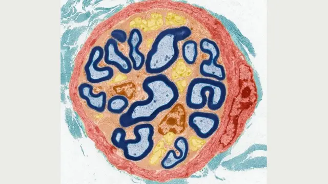Врачи до сих пор пытаются понять, как различия в строении периферической нервной системы могут приводить к этим странным симптомам