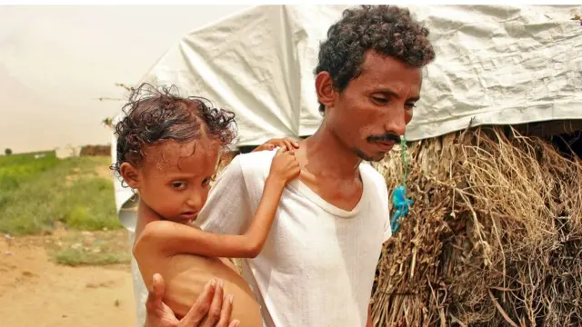 مشردون داخل اليمن